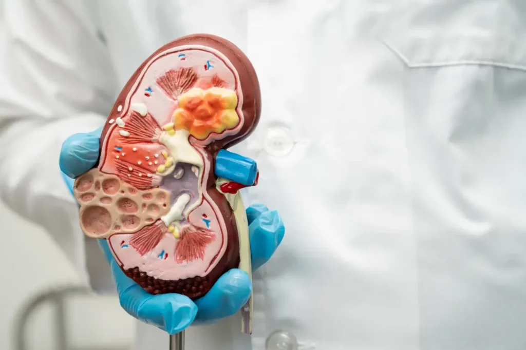 אי ספיקת כליות